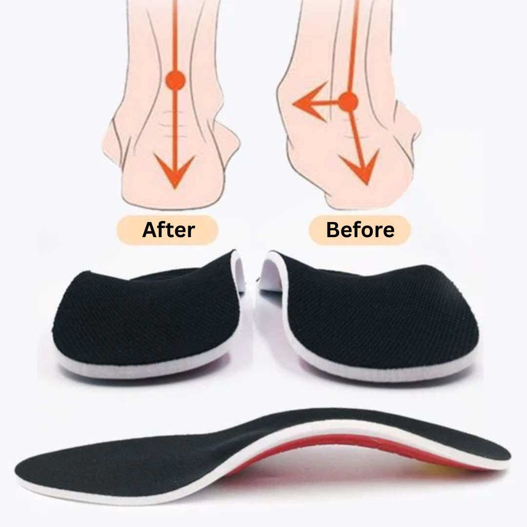 ArchEase™ – Orthopedic Arch Support Insoles